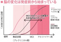 MCBI図